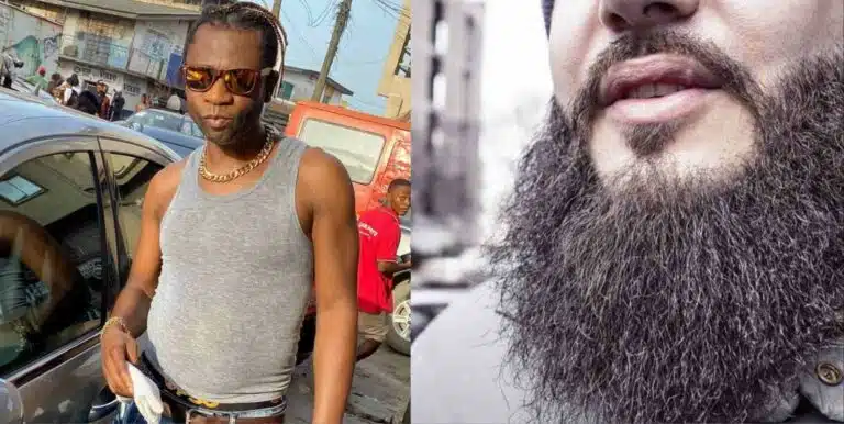 Men Who Have Beards are Not Rich – Speed Darlington (Video)
